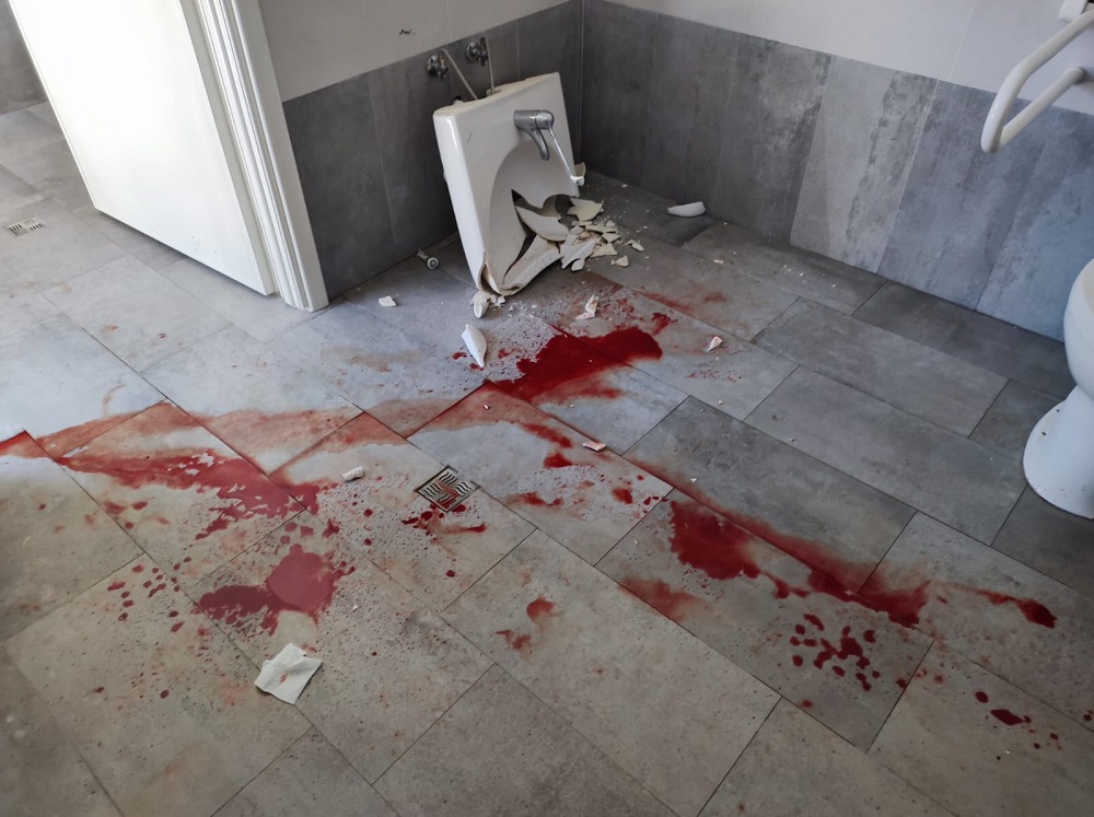 Porto Recanati: cade un lavandino ai bagni pubblici. 14enne di Recanati al pronto soccorso