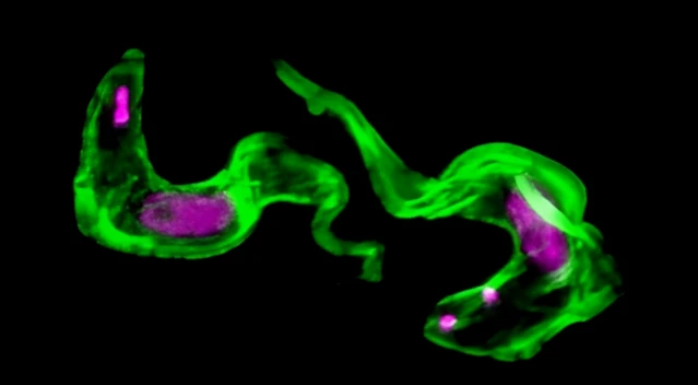 Resuelven un misterio de 40 años sobre rara enfermedad del sueño